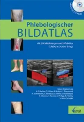 Produktbild von Phlebologischer Bildatlas