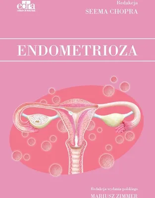 Produktbild von Endometrioza