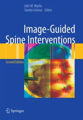 Obrázok produktu pre Image-Guided Spine Interventions