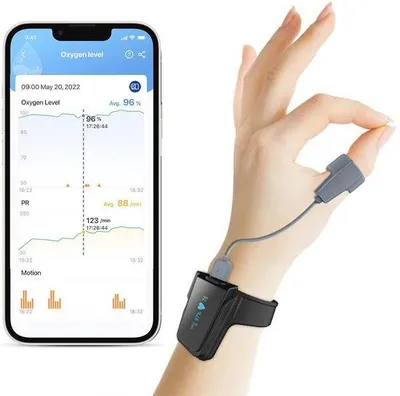 Obrázok produktu pre Pulsný oxymeter s meraním krvného tlaku a srdcovej frekvencie, s Bluetooth a aplikáciou – nočný režim a vibračné upozornenia