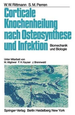 Produktbild von Corticale Knochenheilung nach Osteosynthese und Infektion
