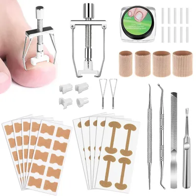 Image de Kit de correction des ongles incarnés, en acier inoxydable et en feutre | Soins professionnels des pieds pour les ongles incarnés | Plus de 100 pièces