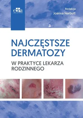 Image de Najczęstsze dermatozy w praktyce lekarza rodzinnego