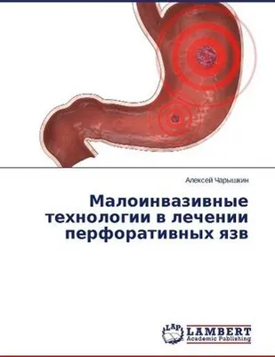 Produktbild von Minimalinvasive Technologien bei der Behandlung von perforativen Läsionen