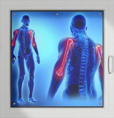 Produktbild von Wallario Lichtschutzbild, Dekorativer Sichtschutz Sonnenschutz 96 x 100 cm mit Motiv: Anatomie Mensch  Oberarmknochen - Verdunklung ohne Bohren