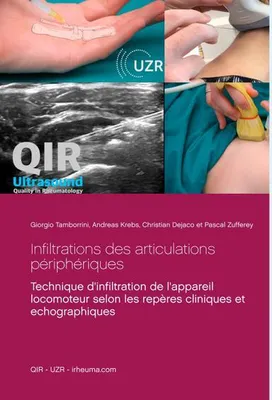 Immagine prodotto di Infiltrations des articulations périphériques