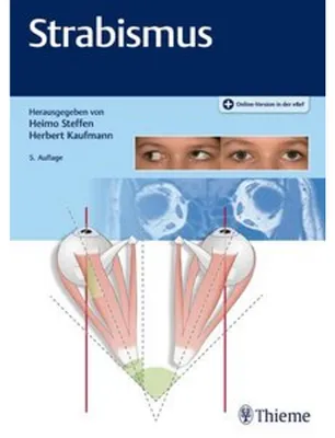 Obrázek produktu pro Strabismus
