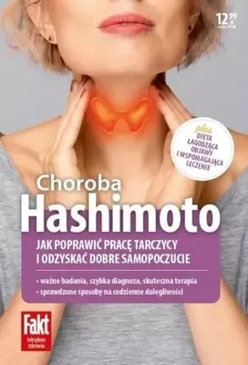 Produktbild von Hashimoto - praca zbiorowa