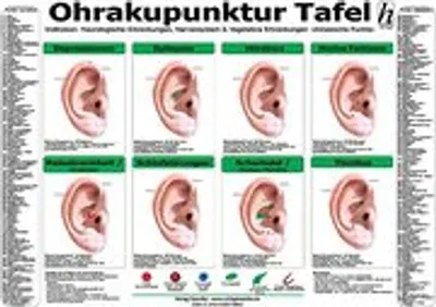 Obrázok produktu pre Ohrakupunktur Tafel - Indikation: Neurologische Erkrankungen, Nervensystem & Vegetative Erkrankungen
