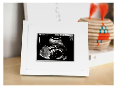 Produktbild von Sonogramm Erinnerungsrahmen, Weiß