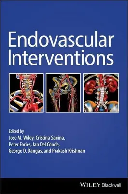 Produktbild von Endovascular Interventions