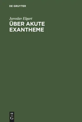 Produktbild von Über akute Exantheme