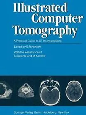 Produktbild von Illustrated Computer Tomography