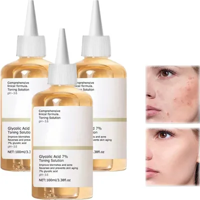 Produktbild von 3x 100ml Glykolsäure 7% tonisierende Resurfacing Lösung Akne Entfernungs feuchtigkeitsspendend Verbessert dunkle Flecken Anti-Aging Gesichtspflege