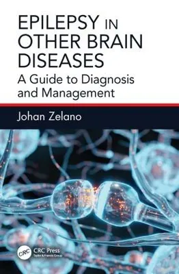 Obrázok produktu pre Epilepsy in Other Brain Diseases