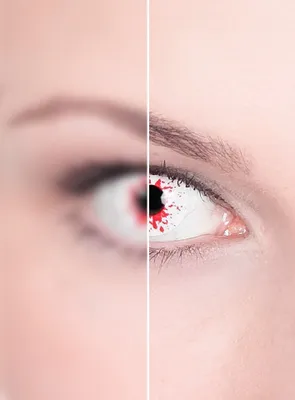 Produktbild von Blutige Dioptrien Kontaktlinse - Karneval Fasching Dioptrien: -3,5