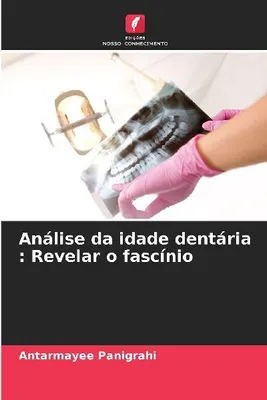 Produktbild von Análise da idade dentária : Revelar o fascínio