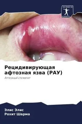 Produktbild von Recidiwiruüschaq aftoznaq qzwa (RAU)
