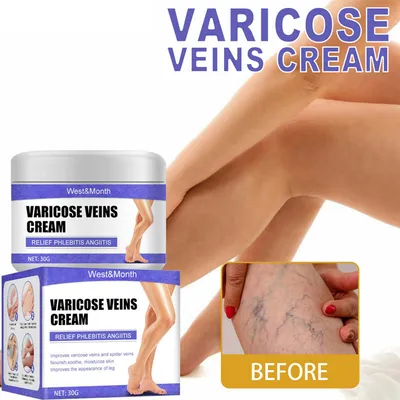 Produktbild von Venenreparaturcreme Venencreme Bein Krampfadern blaue Sehnenschwellung und Schmerzen Beincreme 30g