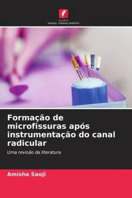Produktbild von Formação de microfissuras após instrumentação do canal radicular