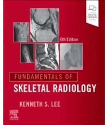 Immagine prodotto di Fundamentals of Skeletal Radiology