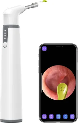 Obrázek produktu pro Teslong Smart Otoscope Wi-Fi otoskop pro kontrolu a čištění ucha