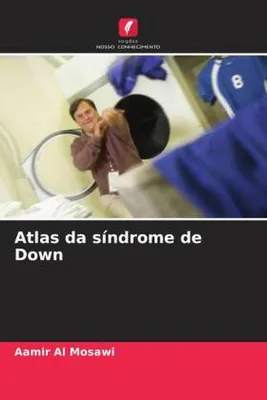 Produktbild von Atlas da síndrome de Down