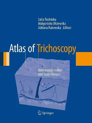 Produktbild von Atlas of Trichoscopy