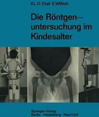 Produktbild von Die Röntgenuntersuchung im Kindesalter