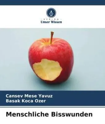 Produktbild von Menschliche Bisswunden