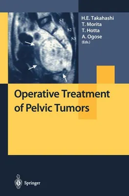 Zdjęcie produktu dla Operative Treatment of Pelvic Tumors