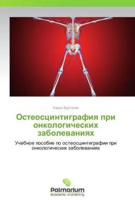 Obrázok produktu pre Osteostsintigrafiya pri onkologicheskikh zabolevaniyakh