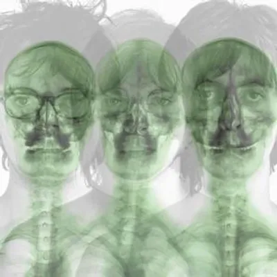 Produktbild von Supergrass (2022 Remastered)