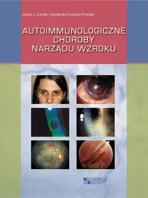 Immagine prodotto di Malattie autoimmuni dell'occhio