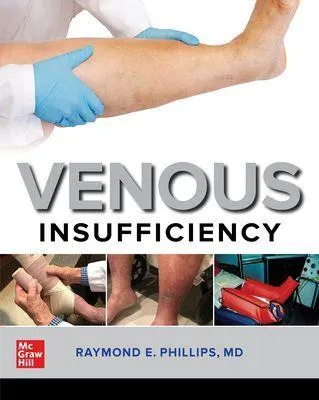 Produktbild von Venous Insufficiency