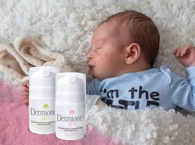 Immagine prodotto di Dermione® - KIT PER LA CURA DELLA PELLE DEI BAMBINI CON SINTOMI DI DERMATITE ATOPICA