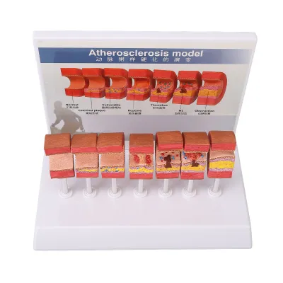 Obrázok produktu pre Model anatómie tepny, 7 kusov modelu tepny, model anatómie, model tepny ľudského tela, anatomický model tepny, model cievneho trombu, model anatómie ľudskej tepny