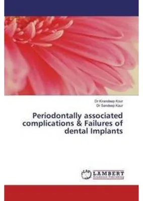 Obrázok produktu pre Periodontally associated complications & Failures of dental Implants