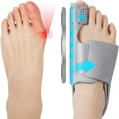 Produktbild von Hallux Valgus Korrektur Schiene mit Zehenspreizer, 2er Set, Grau, Verstellbar