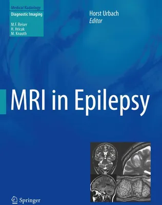 Produktbild von MRI in Epilepsy