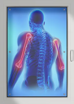 Produktbild von Wallario Lichtschutzbild, Dekorativer Sichtschutz Sonnenschutz 76 x 115 cm mit Motiv: Anatomie Mensch  Oberarmknochen - Verdunklung ohne Bohren