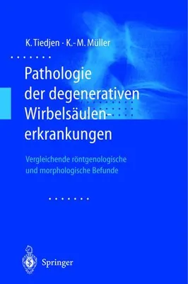 Image de Pathologie der degenerativen Wirbelsäulenerkrankungen