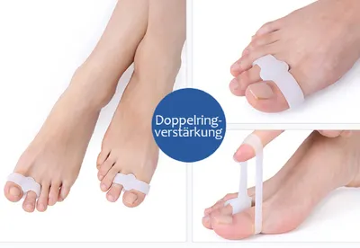 Produktbild von COOL-i® Zehenkorrektor Set – 1 Paar Gel-Zehentrenner bei Hallux Valgus & überlappenden Zehen – Wiederverwendbar & angenehm
