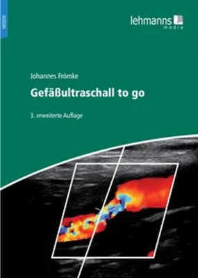 Image de Gefäßultraschall to go