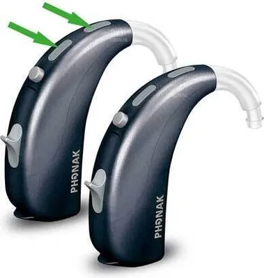 Produktbild von Filtre Phonak proti vetru a počasiu Mikrofiltre