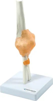 Produktbild von Ellbogen Anatomie Modell lebensgroß mit Ligamenten auf Stativ
