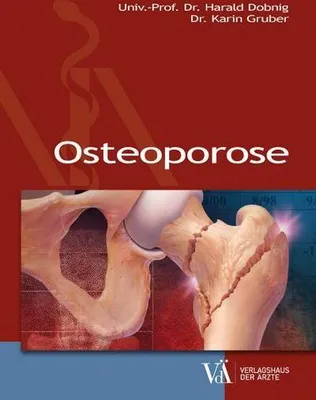 Produktbild von Osteoporose