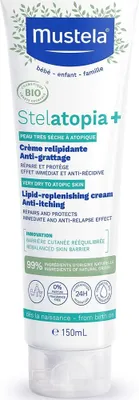 Produktbild von Mustela Stelatopia+ Pflegende Beruhigende Lipid-Rückfettende Creme gegen Juckreiz 150 ml