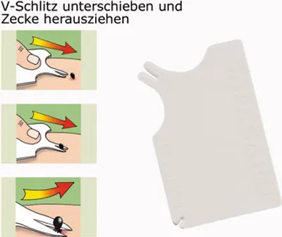 Produktbild von ARIES® Anti Zeck Zeckenkarte 1 Stück