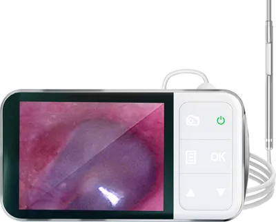 Produktbild von 3,9 mm Digital-Otoskop-Endoskop, 4,5-Zoll 1080P-Ohrkamera mit 6 Lichtern, Ohrenschmalzentfernung , mit Aufbewahrungstasche,